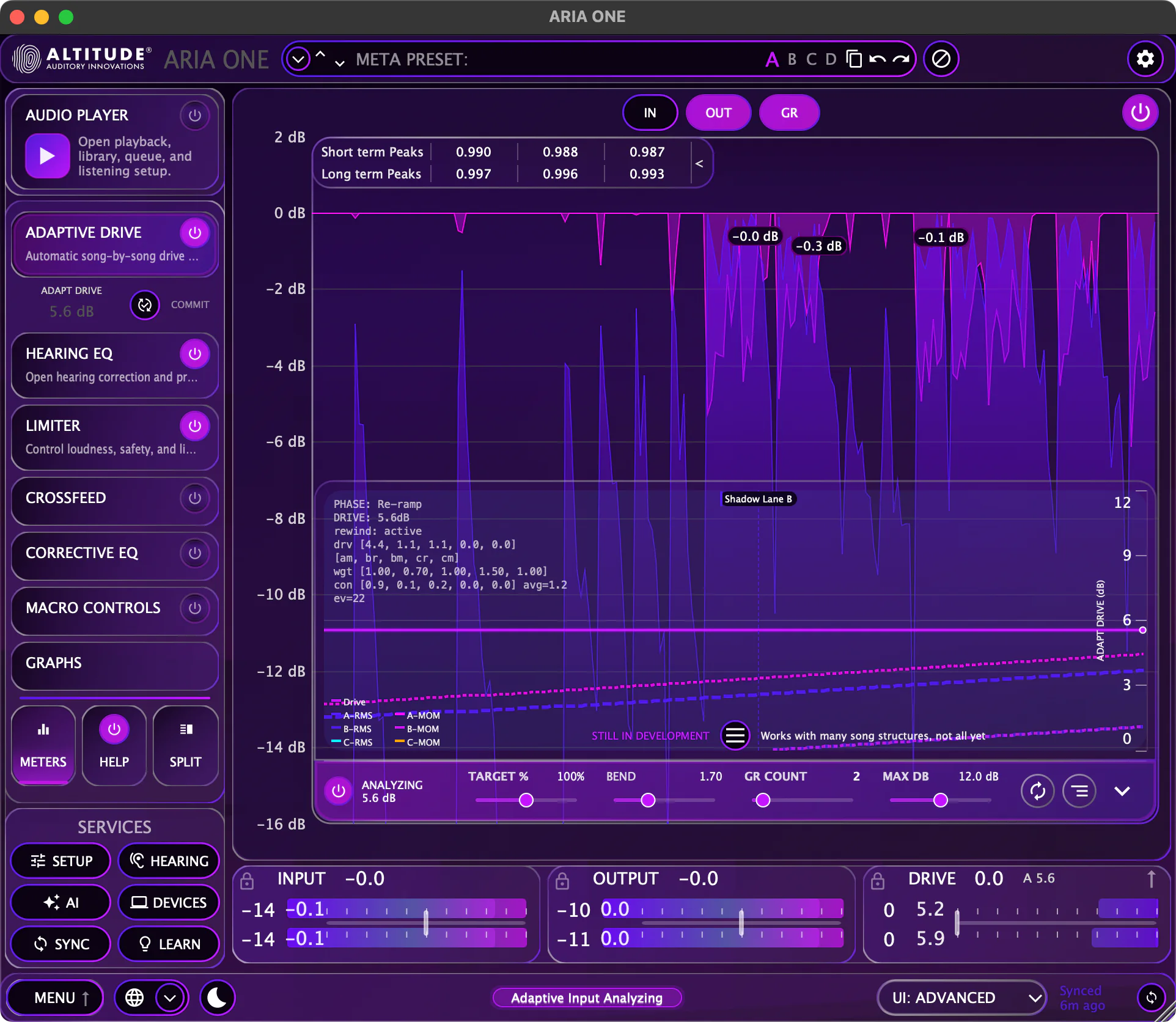 ARIA ONE Advanced View with EQ correction, hearing profiles, and frequency response curves